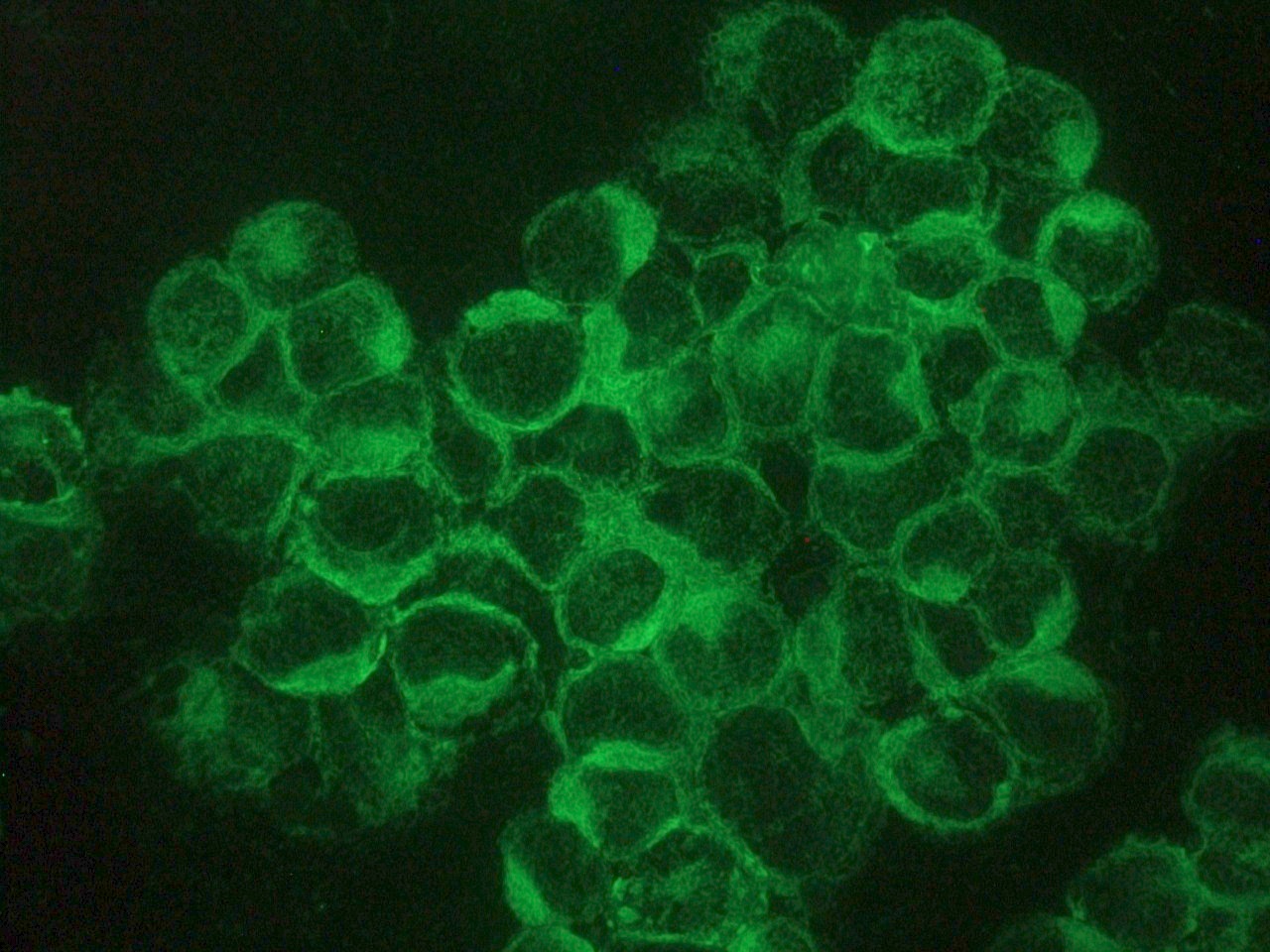 Figure 1. Indirect immunofluorescence staining of reticulons-1A and 1B (NSP-A and NSP-B) in methanol fixed NCI-H82 small cell lung cancer cells using MUB1313P (RNL-2; diluted 1:100).